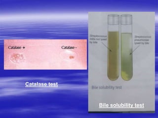 Catalase test
Bile solubility test
 