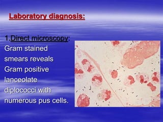 Laboratory diagnosis:
1.Direct microscopy:
Gram stained
smears reveals
Gram positive
lanceolate
diplococci with
numerous pus cells.
 