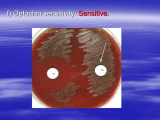 f) Optochin sensitivity: Sensitive.
 