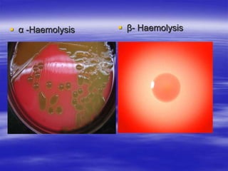 α -Haemolysis  β- Haemolysis
 
