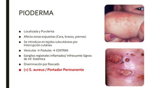 Strep. Pyogenes Pyoderma STREPTOCOCCUS PYOGENES | PPTX