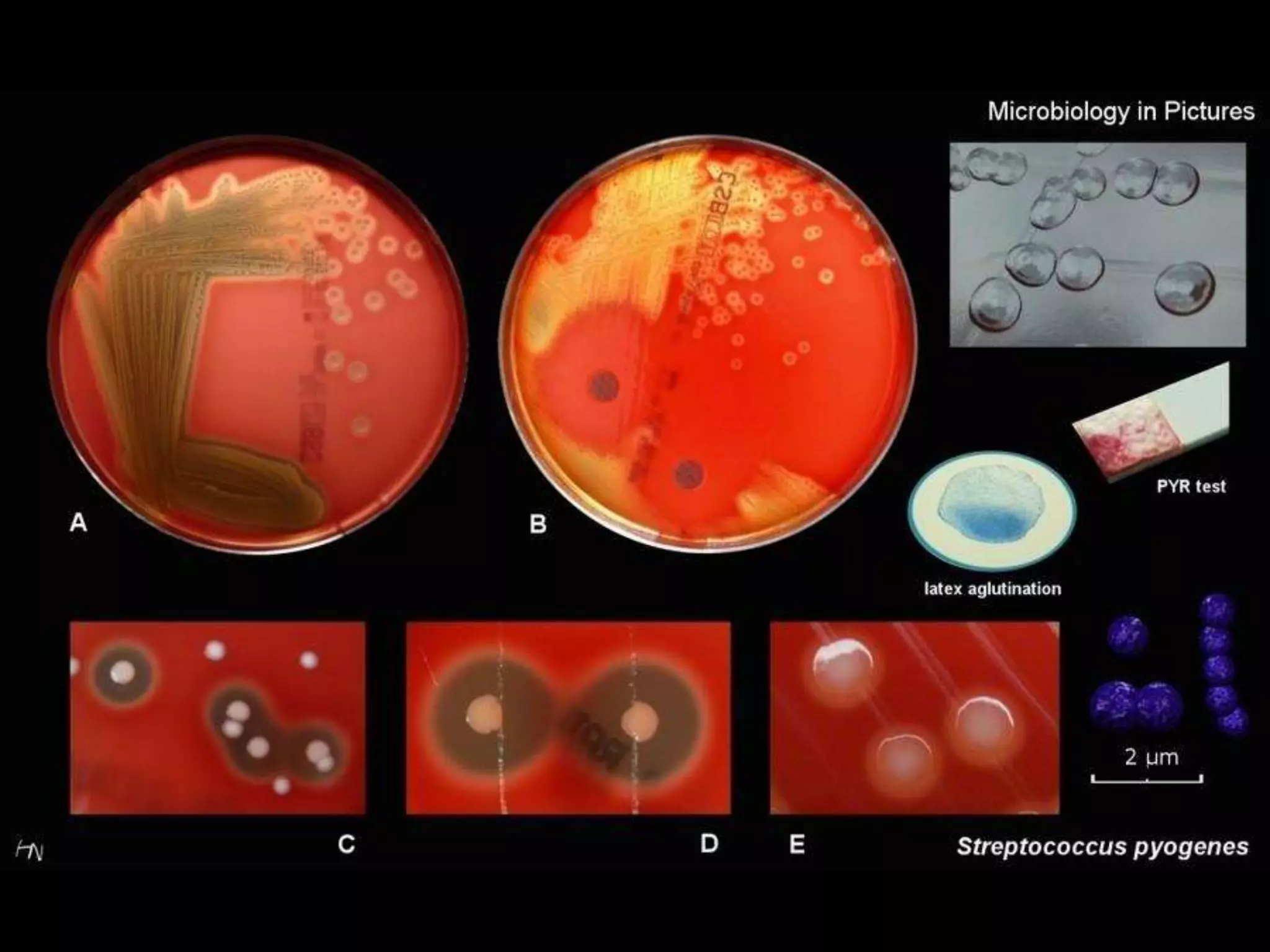 Strep. Pyogenes Slide Streptococcus (pyogenes, neumo, agalact y entero) | PPTX