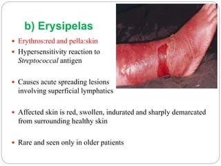 b) Erysipelas
 Erythros:red and pella:skin
 Hypersensitivity reaction to
Streptococcal antigen
 Causes acute spreading lesions
involving superficial lymphatics
 Affected skin is red, swollen, indurated and sharply demarcated
from surrounding healthy skin
 Rare and seen only in older patients
 