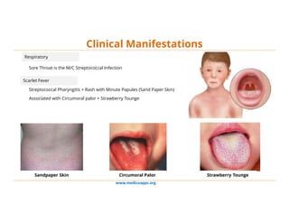 www.medicoapps.org
Clinical Manifestations
Respiratory
Sore Throat is the M/C Streptococcal Infection
Scarlet Fever
Strept...