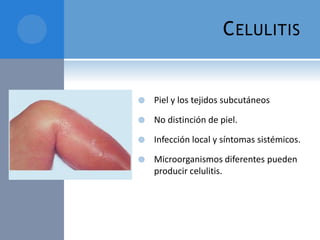 C ELULITIS



Piel y los tejidos subcutáneos



No distinción de piel.



Infección local y síntomas sistémicos.



Microorganismos diferentes pueden
producir celulitis.

 