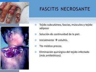FASCITIS NECROSANTE



Tejido subcutáneo, fascias, músculos y tejido
adiposo



Solución de continuidad de la piel.



Inicialmente  celulitis.



Tto médico precoz.



Eliminación quirúrgica del tejido infectado
(más antibióticos).

 