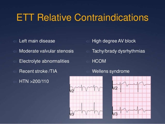Stress Test Lecture