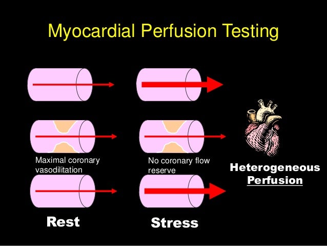 Persantine Thallium Stress Test