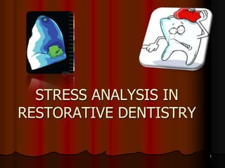 STRESS ANALYSIS IN
RESTORATIVE DENTISTRY
1
 