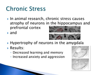 The Effects of Stress And The Brain | PDF