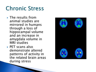 The Effects of Stress And The Brain | PDF