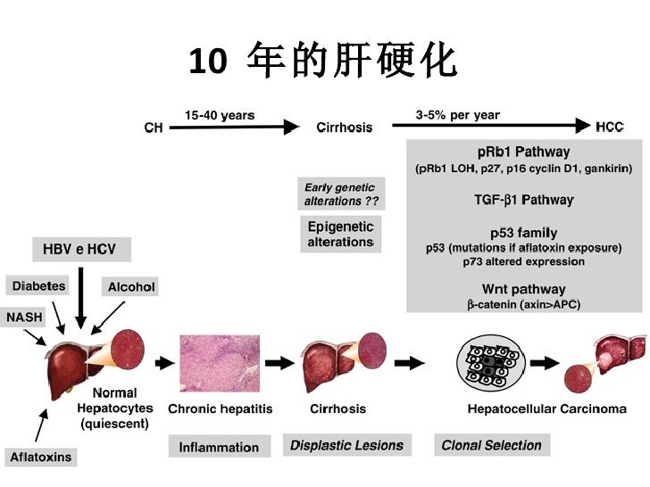 Stress Blood Glucose Rise