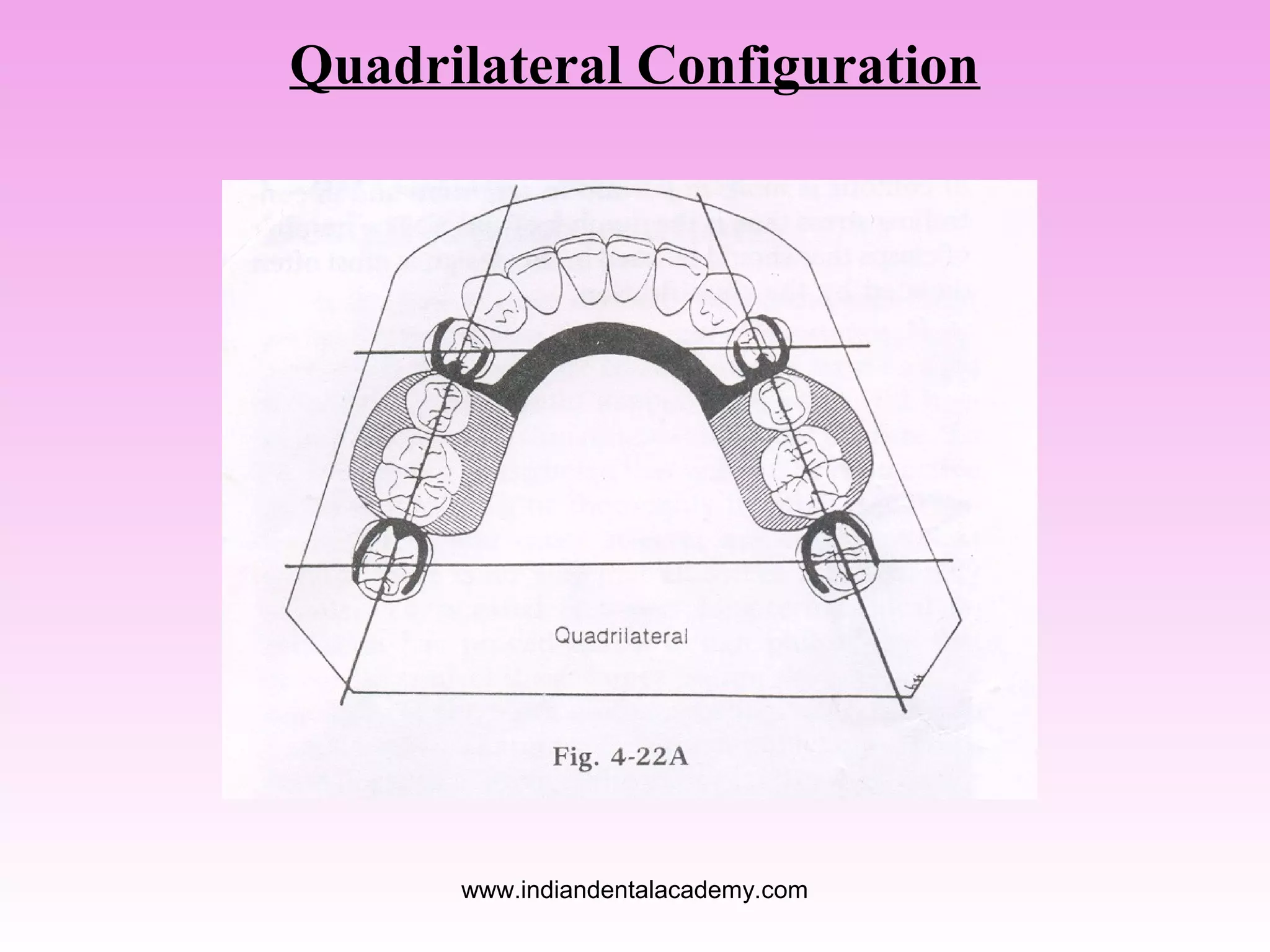 Quadrilateral Configuration

www.indiandentalacademy.com

 