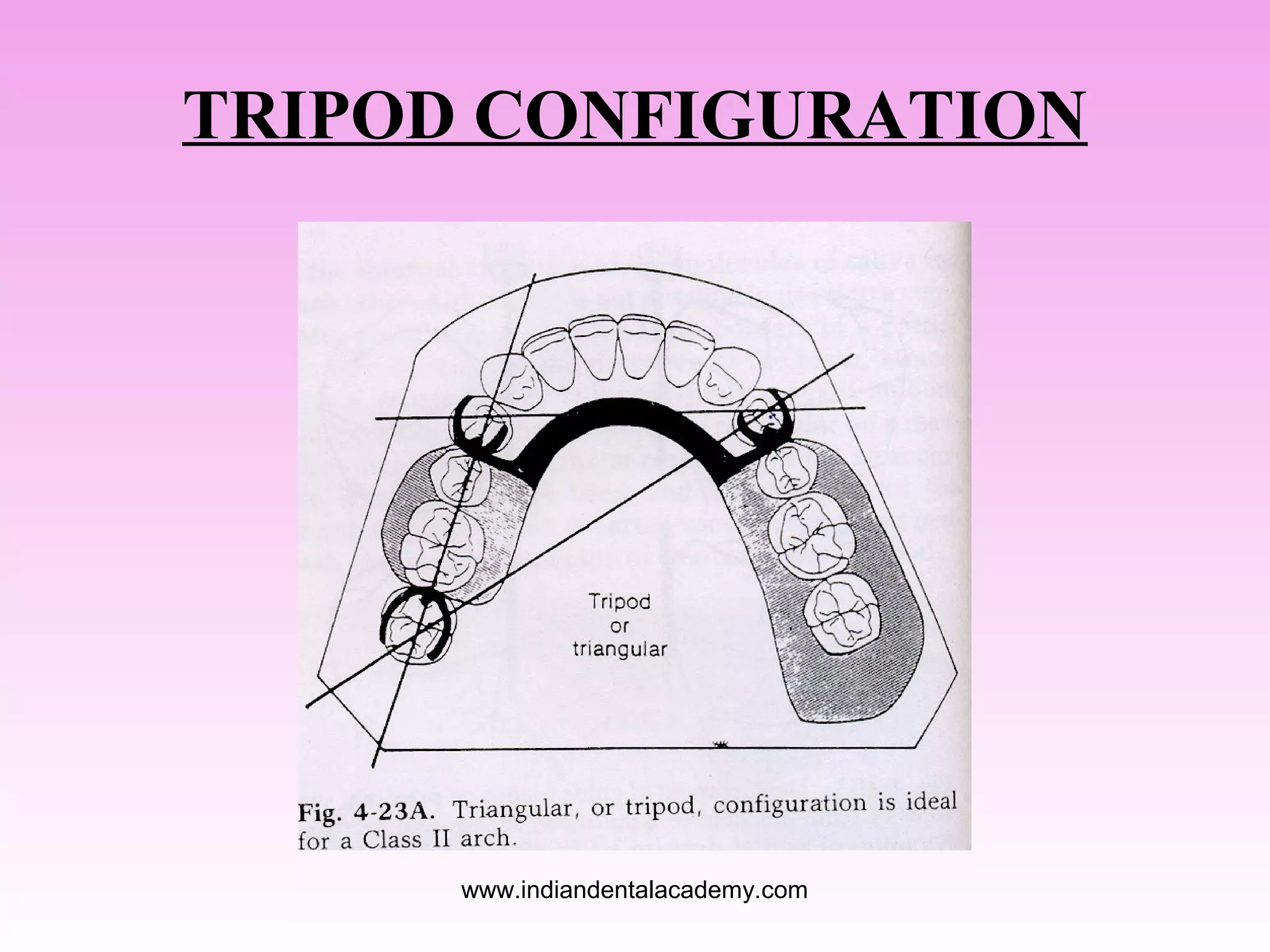 TRIPOD CONFIGURATION

www.indiandentalacademy.com

 