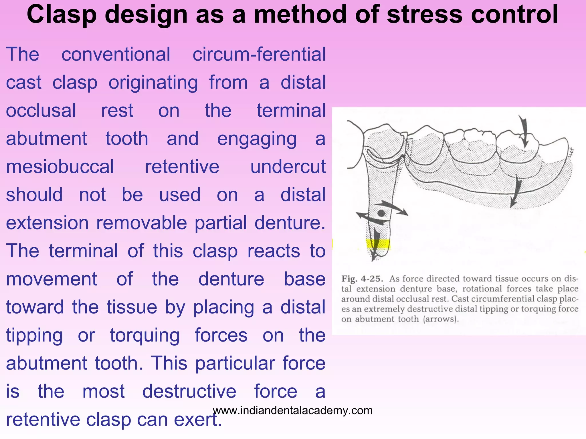 Clasp design as a method of stress control
The conventional circum-ferential
cast clasp originating from a distal
occlusal rest on the terminal
abutment tooth and engaging a
mesiobuccal
retentive
undercut
should not be used on a distal
extension removable partial denture.
The terminal of this clasp reacts to
movement of the denture base
toward the tissue by placing a distal
tipping or torquing forces on the
abutment tooth. This particular force
is the most destructive force a
www.indiandentalacademy.com
retentive clasp can exert.

 