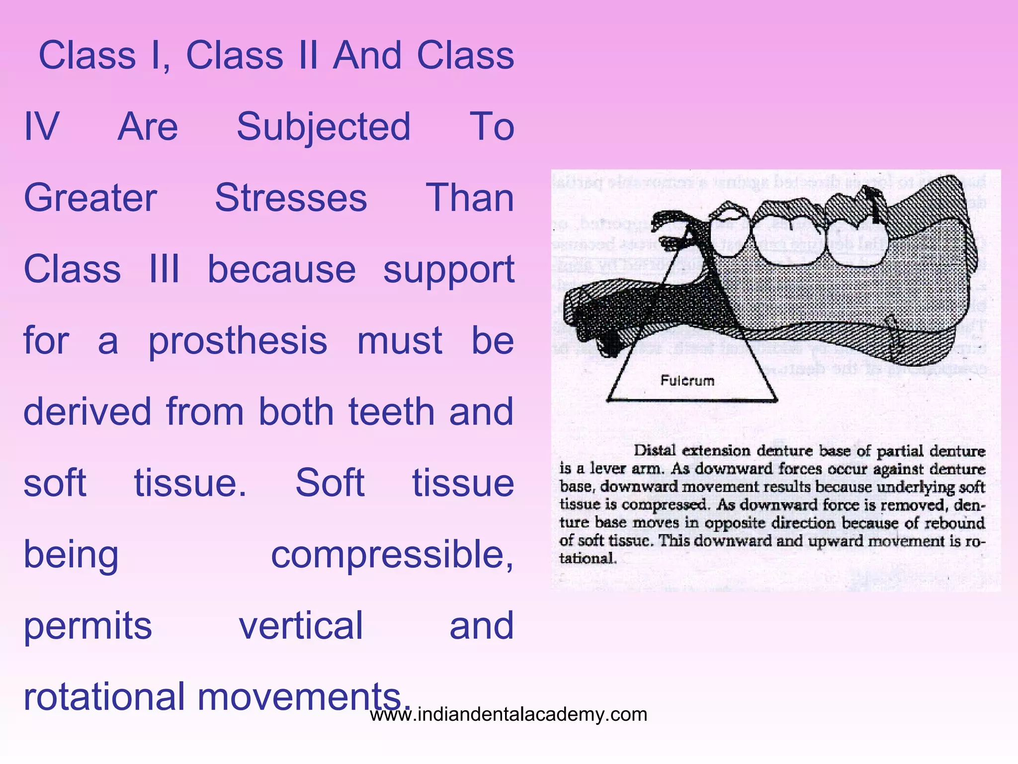Class I, Class II And Class
IV

Are

Greater

Subjected
Stresses

To
Than

Class III because support
for a prosthesis must be
derived from both teeth and
soft

tissue.

being
permits

Soft

tissue

compressible,
vertical

and

rotational movements.
www.indiandentalacademy.com

 