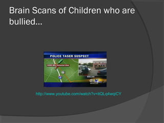 Brain Scans of Children who are
bullied…




      http://www.youtube.com/watch?v=itQLq4wqiCY
 