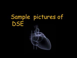 Sample pictures of
DSE
 