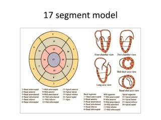 17 segment model
 