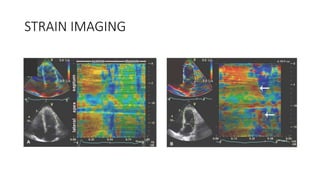 STRAIN IMAGING
 