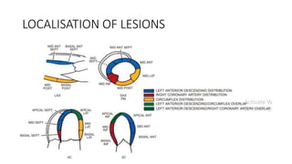 LOCALISATION OF LESIONS
 