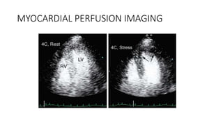 MYOCARDIAL PERFUSION IMAGING
 