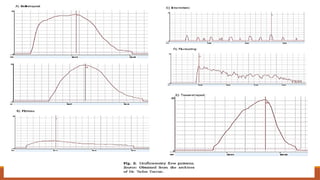 Stress Incontinence MANAGEMENT IN PHYSIOTHERAPY | PPTX