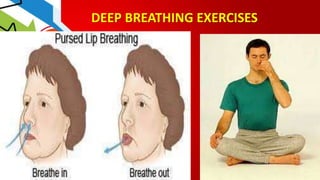DEEP BREATHING EXERCISES
 