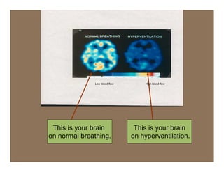 Low blood flow       High blood flow




 This is your brain             This is your brain
on normal breathing.           on hyperventilation.
 