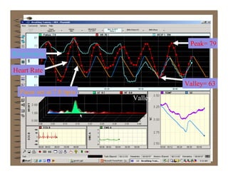 Peak= 79
Respiration

Heart Rate
                                  Valley= 63
  Pacer set at 7.0 bpm
                         Valley




        9/11/2007                       35
 