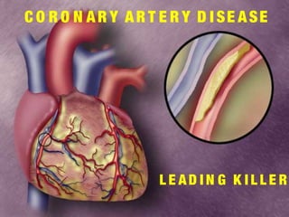 C O R O N AR Y AR T E R Y D I SE ASE
L E AD I N G K I L L E R
 