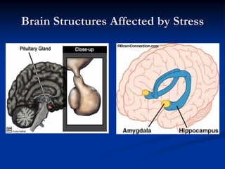 Brain Structures Affected by Stress
 