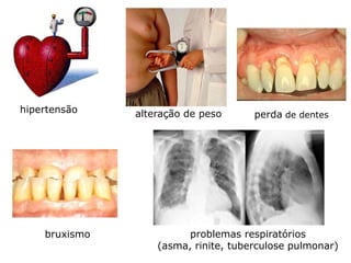 hipertensão    alteração de peso      perda de dentes




    bruxismo             problemas respiratórios
                   (asma, rinite, tuberculose pulmonar)
 