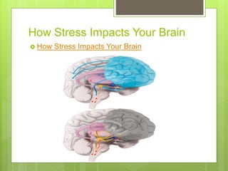 How Stress Impacts Your Brain
 How Stress Impacts Your Brain
 