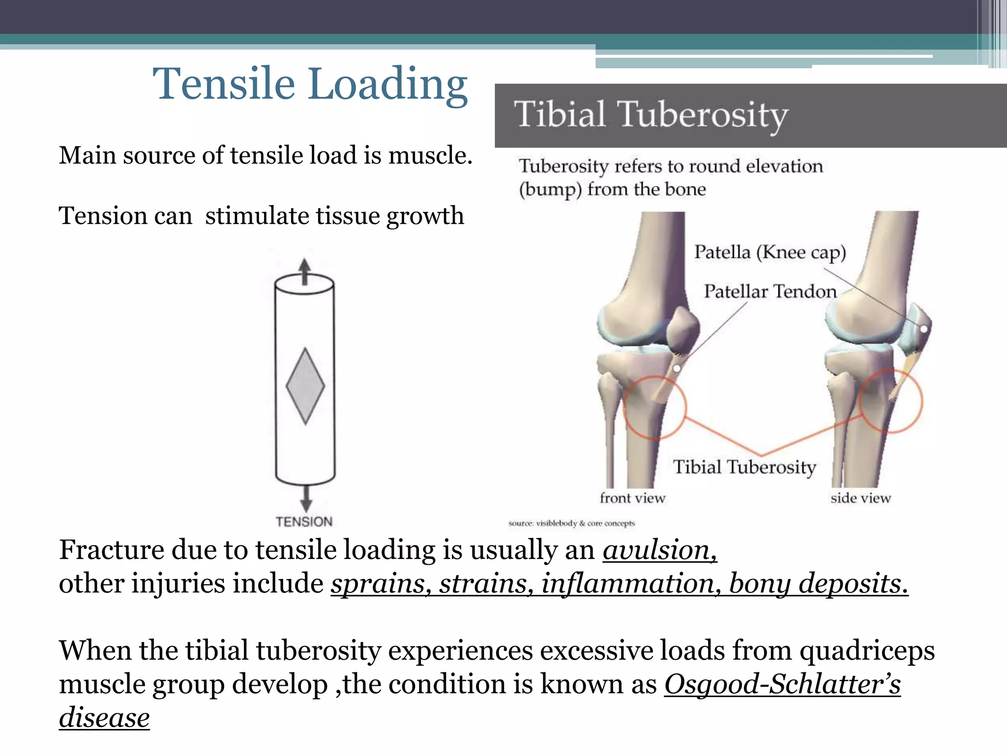 Tensile Loading
Main source of tensile load is muscle.
Tension can stimulate tissue growth
Fracture due to tensile loading is usually an avulsion,
other injuries include sprains, strains, inflammation, bony deposits.
When the tibial tuberosity experiences excessive loads from quadriceps
muscle group develop ,the condition is known as Osgood-Schlatter’s
disease
 