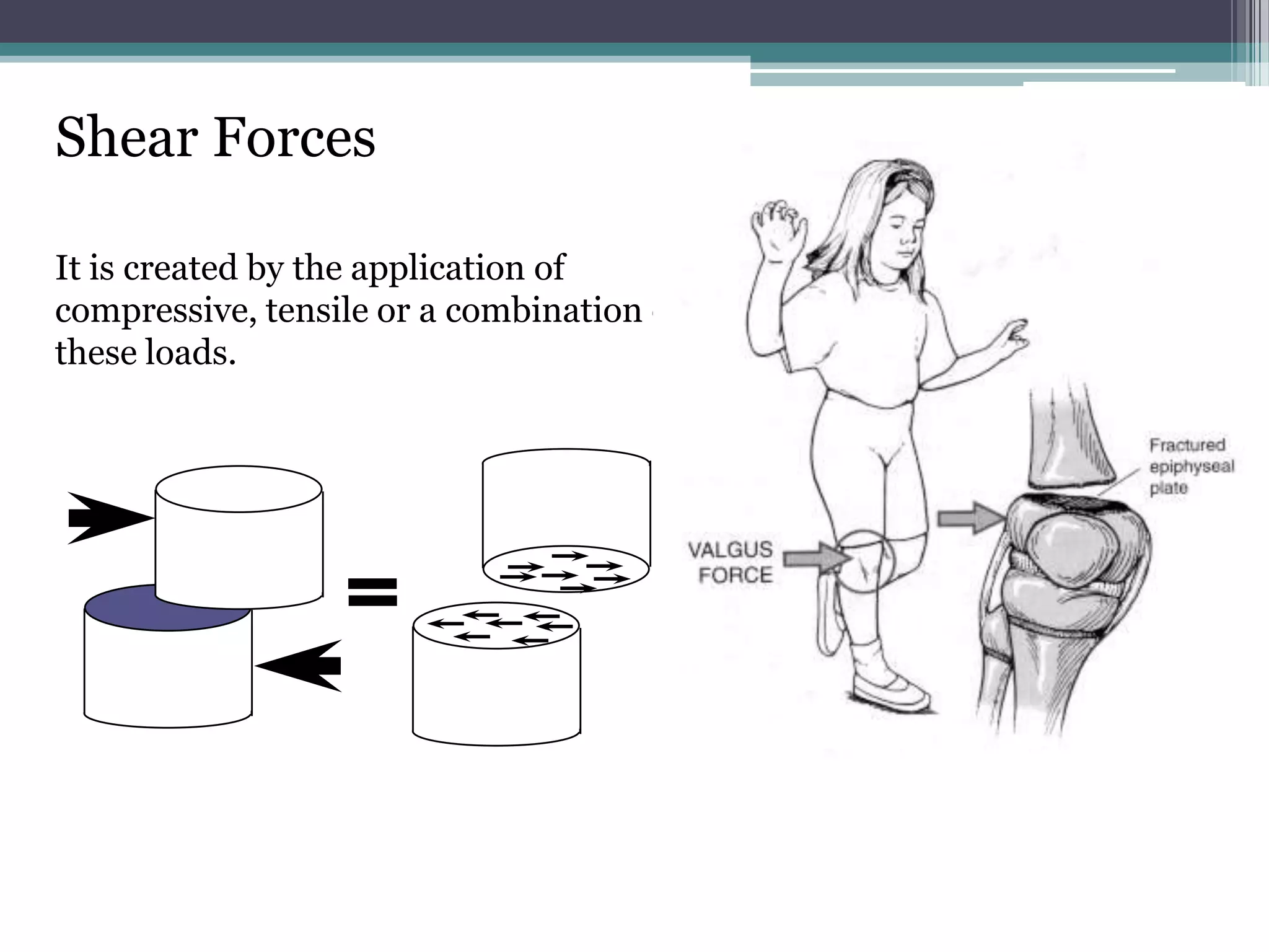 Shear Forces
It is created by the application of
compressive, tensile or a combination of
these loads.
 