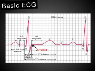 Interpretation of Stress test