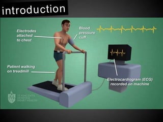 Interpretation of Stress test