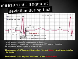 Interpretation of Stress test