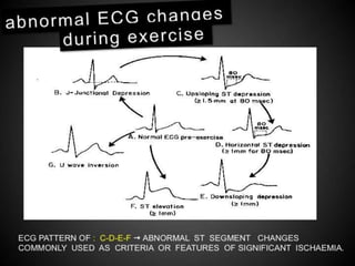 Interpretation of Stress test