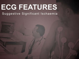 Interpretation of Stress test