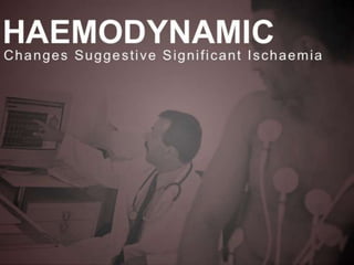 Interpretation of Stress test