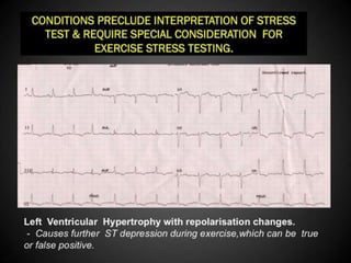 Interpretation of Stress test