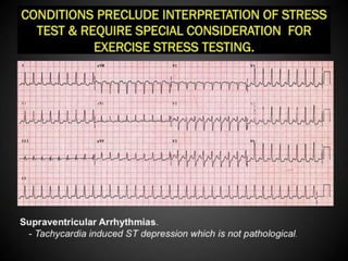 Interpretation of Stress test