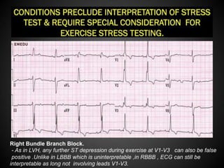 Interpretation of Stress test