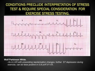 Interpretation of Stress test