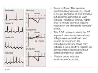 41
 Bruce protocol. The exercise
electrocardiographic (ECG) result
is not yet abnormal at 8:50 minutes
but becomes abnormal at 9:30
minutes (horizontal arrows, right)
of a 12-minute exercise test and
resolves in the immediate recovery
phase.
 This ECG pattern in which the ST
segment becomes abnormal only
at high exercise workloads and
returns to baseline in the
immediate recovery phase may
indicate a false-positive result in an
asymptomatic individual without
atherosclerotic risk factors.
 Vertical arrow indicates
termination of exercise.
 