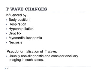 T WAVE CHANGES
42
Influenced by:
 Body position
 Respiration
 Hyperventilation
 Drug Rx
 Myocardial ischaemia
 Necrosis
Pseudonormalisation of T wave:
 Usually non-diagnostic and consider ancillary
imaging in such cases.
 