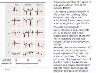 43
 Pseudonormalization of T waves in
a 49-year-old man referred for
exercise testing.
 The resting electrocardiogram in
this patient with coronary artery
disease shows inferior and
anterolateral T wave inversion, an
adverse long-term prognosticator.
 The patient exercised to 8
METs, reaching a peak heart rate
of 142 beats/min and a peak
systolic blood pressure of 248 mm
Hg. At that point, the test was
stopped because of hypertension.
During
exercise, pseudonormalization of T
waves occurs, and it returns to
baseline (inverted T wave) in the
postexercise phase. Transient
conversion of a negative T wave at
rest to a positive T wave during
exercise is a nonspecific finding in
patients without prior myocardial
infarction and does not enhance
 