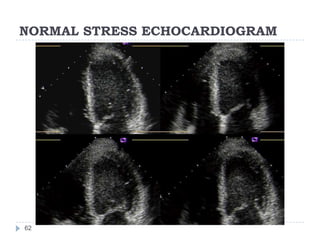 NORMAL STRESS ECHOCARDIOGRAM
62
 